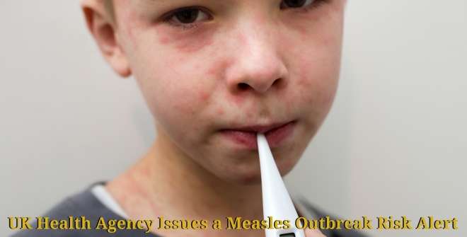 UK Health Agency Issues a Measles Outbreak Risk Alert